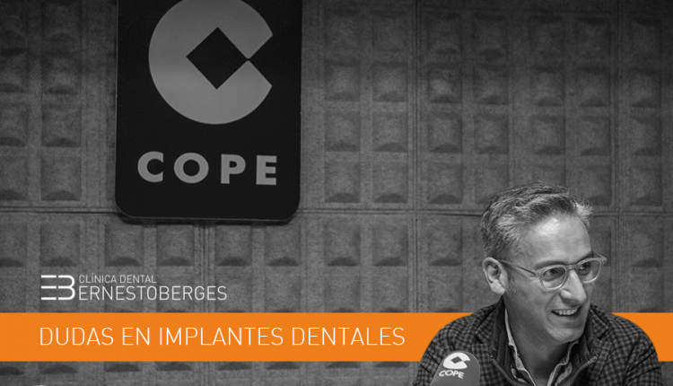 dudas-sobre-implantes-dentales-clinica-dental-berges