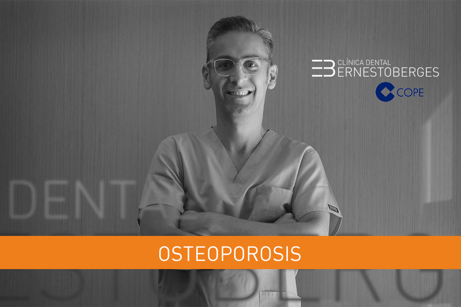 osteoporosis-clinica-dental-berges
